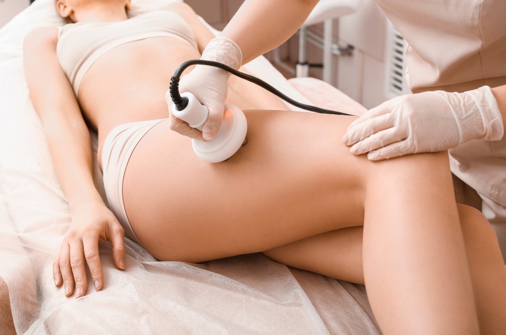 trattamento anticellulite efficace